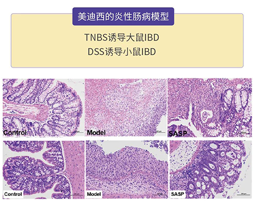 尊龙凯时 - 人生就是搏!的炎症性肠病模型