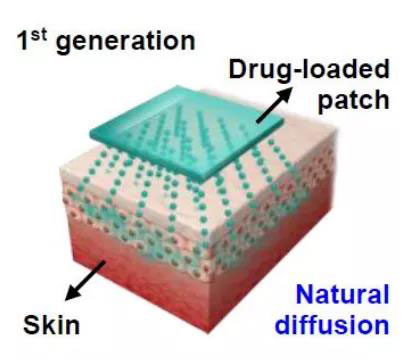 第一代透皮给药技术：通过药物的自然扩散.jpg