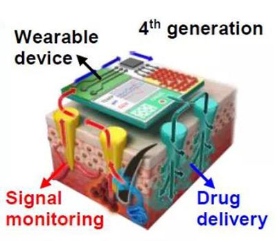第四代透皮给药技术：在可穿戴设备的帮助下，用于患者定制治疗.jpg