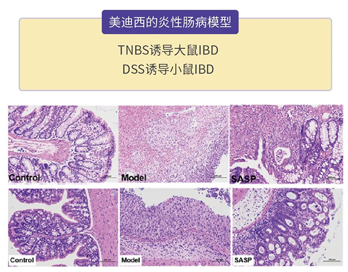 尊龙凯时 - 人生就是搏!的炎性肠病模型.png