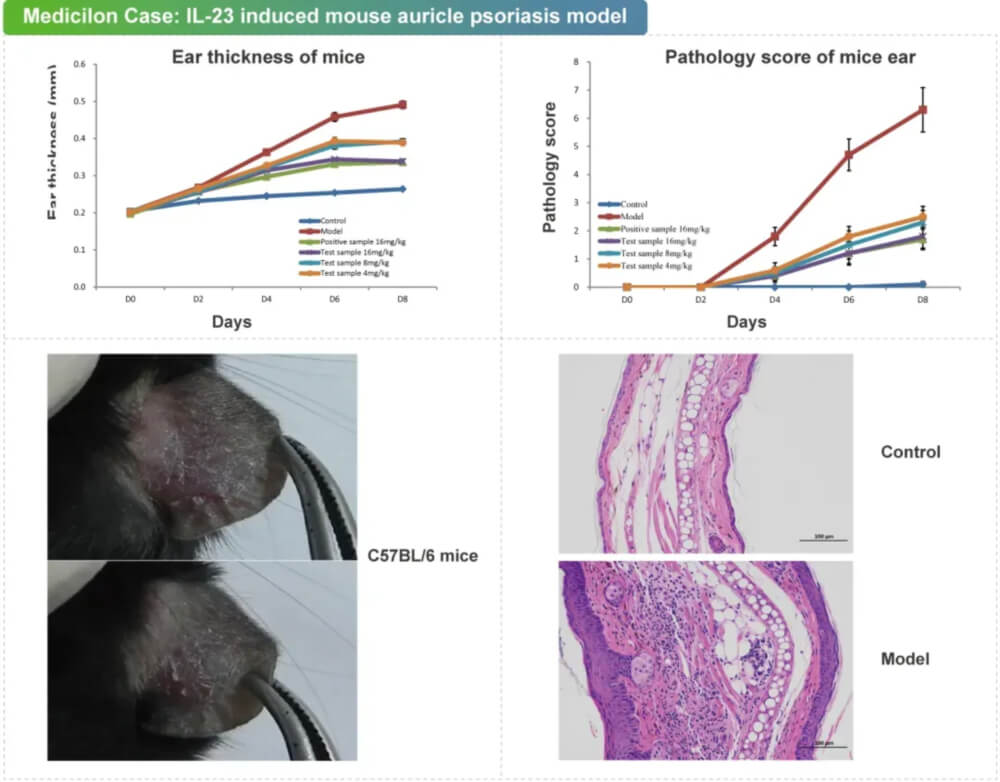 06 IL-23诱导的小鼠耳廓银屑病模型.jpg
